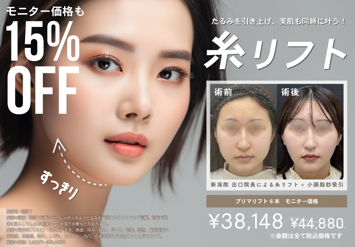 値下げした糸リフトがさらに割引で最大31％OFF!