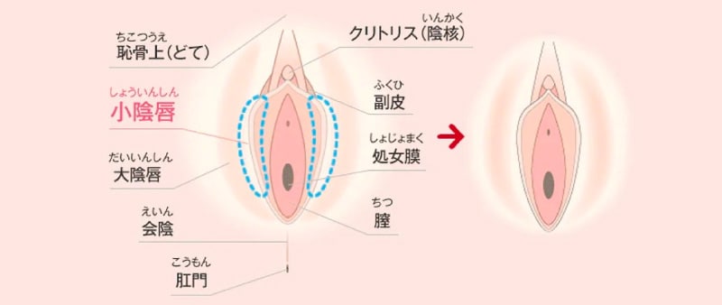 婦人科形成チェックリスト