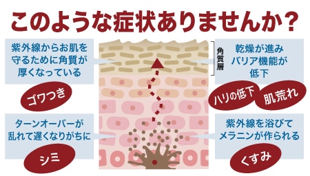 トラブルが起こりやすくなっているお肌状態に