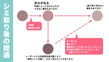 ダウンタイムの症状は？