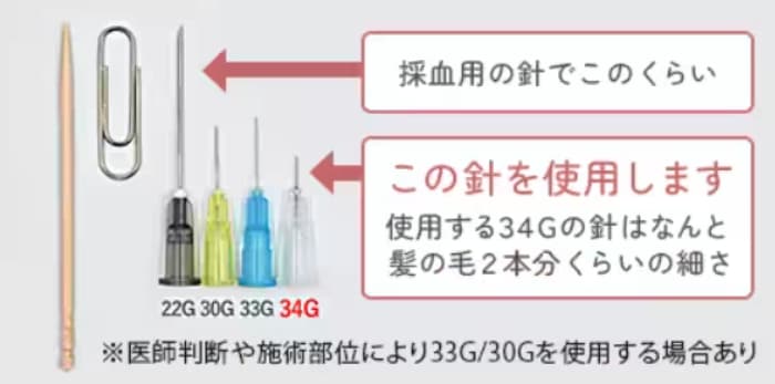 痛みや内出血も出にくい