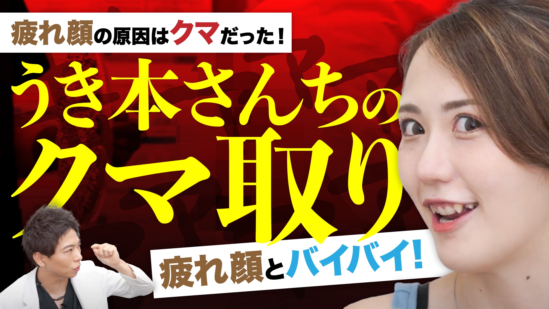 【大人気Youtuber・うき本さんち】目の下の「クマ取り」を平田院長が執刀！【裏ハムラ法】