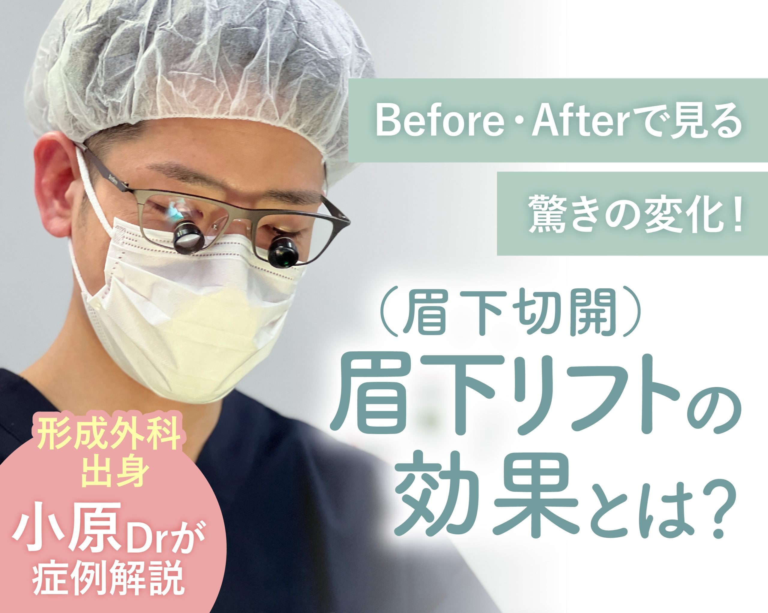 眉下リフト（眉下切開）の効果とは？Before・Afterで見る驚きの変化！