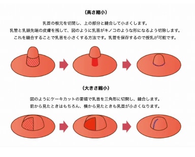 気になる大きさ・形を整えます！