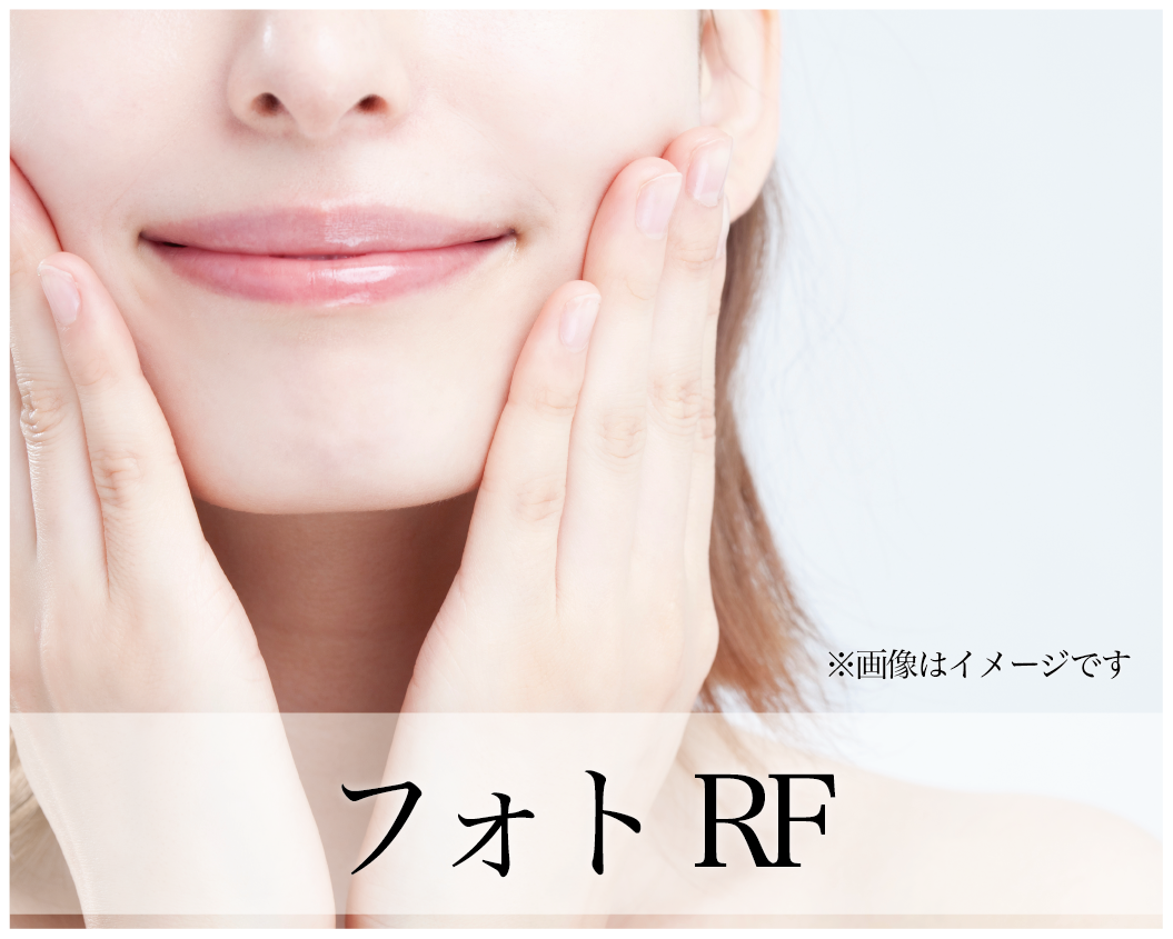 フォトRF