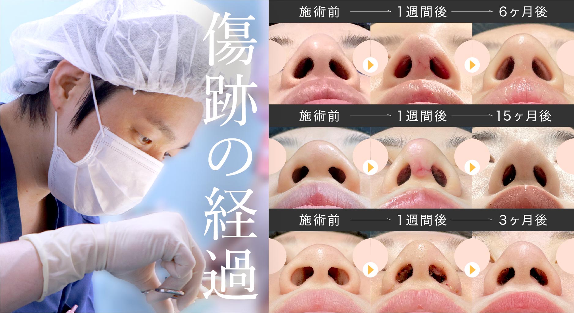 高い技術力を持つ形成外科専門医