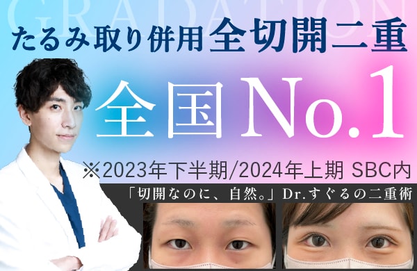 たるみ取り併用全切開法二重術