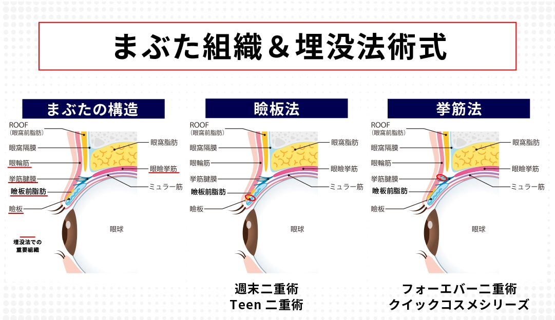 まず、まぶたの構造から理解しましょう。