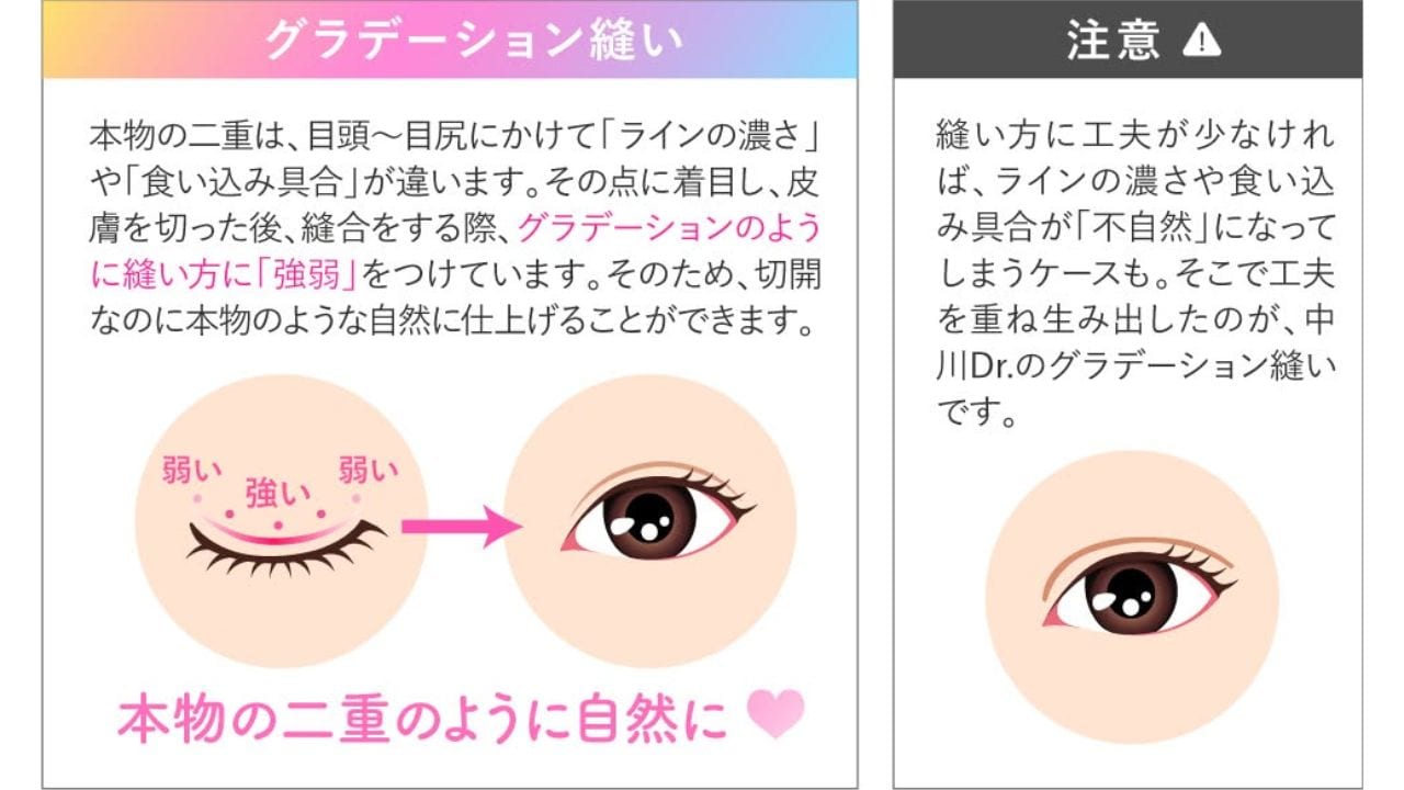 切開なのに自然、その秘訣は「グラデーション縫い」