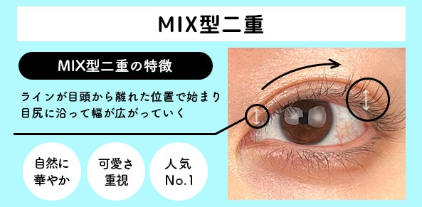 「MIX型二重」の特徴