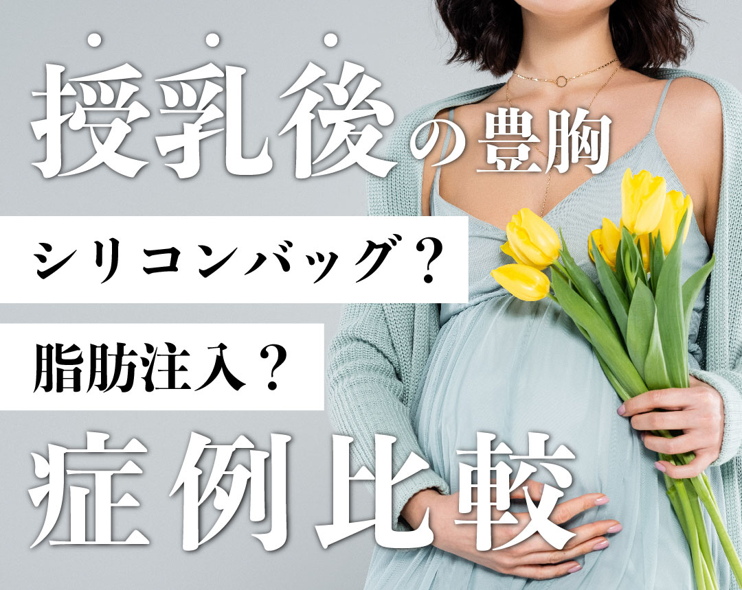 【授乳後 豊胸】授乳後の豊胸って脂肪注入かシリコンバッグどっちがいいの？