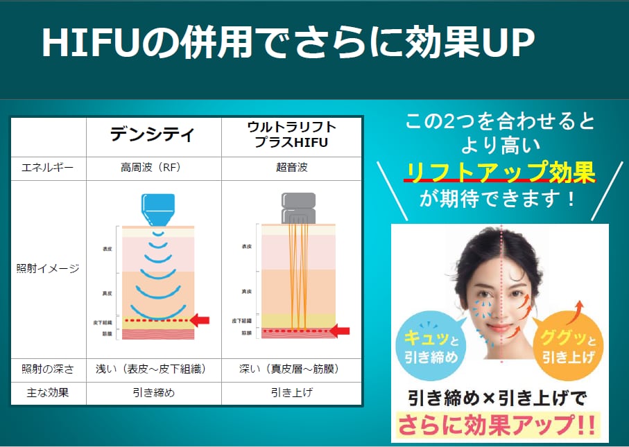 デンシティは、ウルトラリフトプラスHIFU（ハイフ）との併用がオススメ！