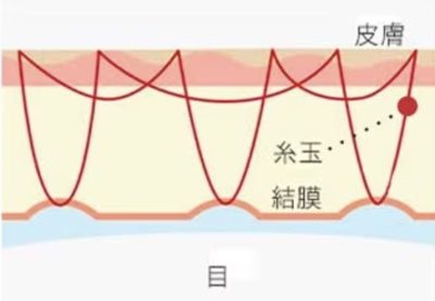 施術の解説