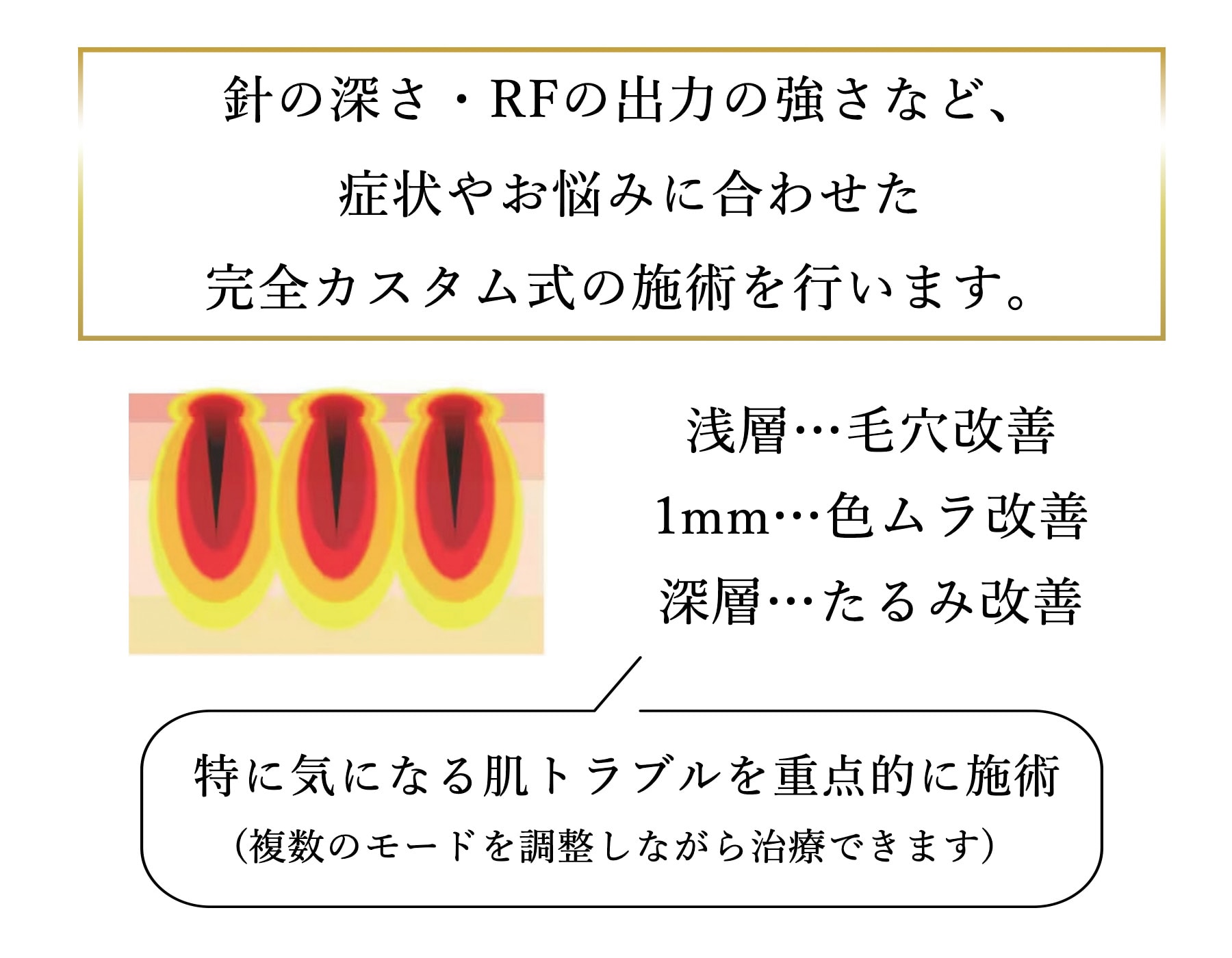 肌状態に合わせた完全カスタム式