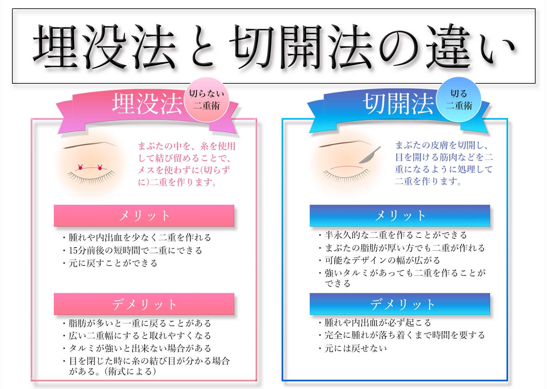 埋没法と切開法の違い