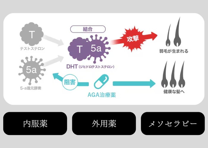 大きく分けて３つ！