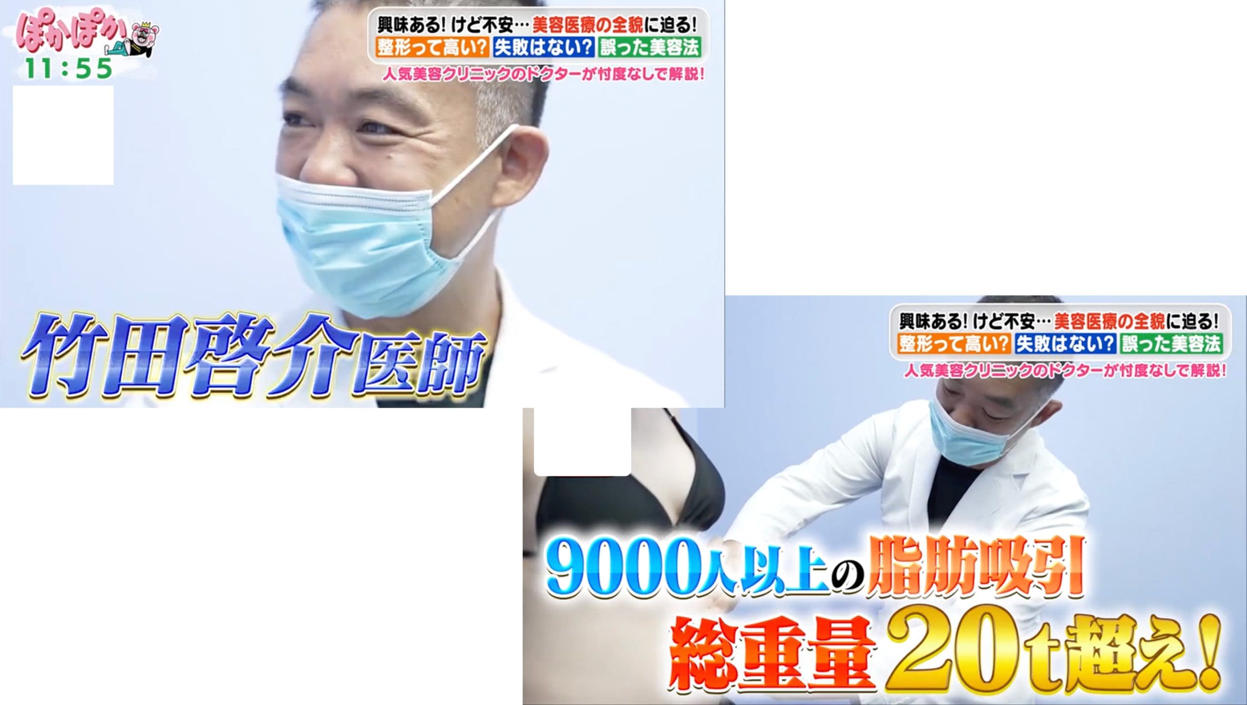 医師歴19年 SBC脂肪吸引最高責任者！竹田啓介医師の経歴を深掘り<br />
今までに採った脂肪の総重量２t ⁉︎ 9000人以上の脂肪吸引を担当した経歴の持ち主。