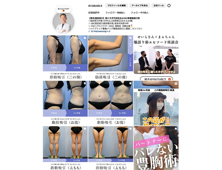 変化率のある症例写真を公開しているかどうか