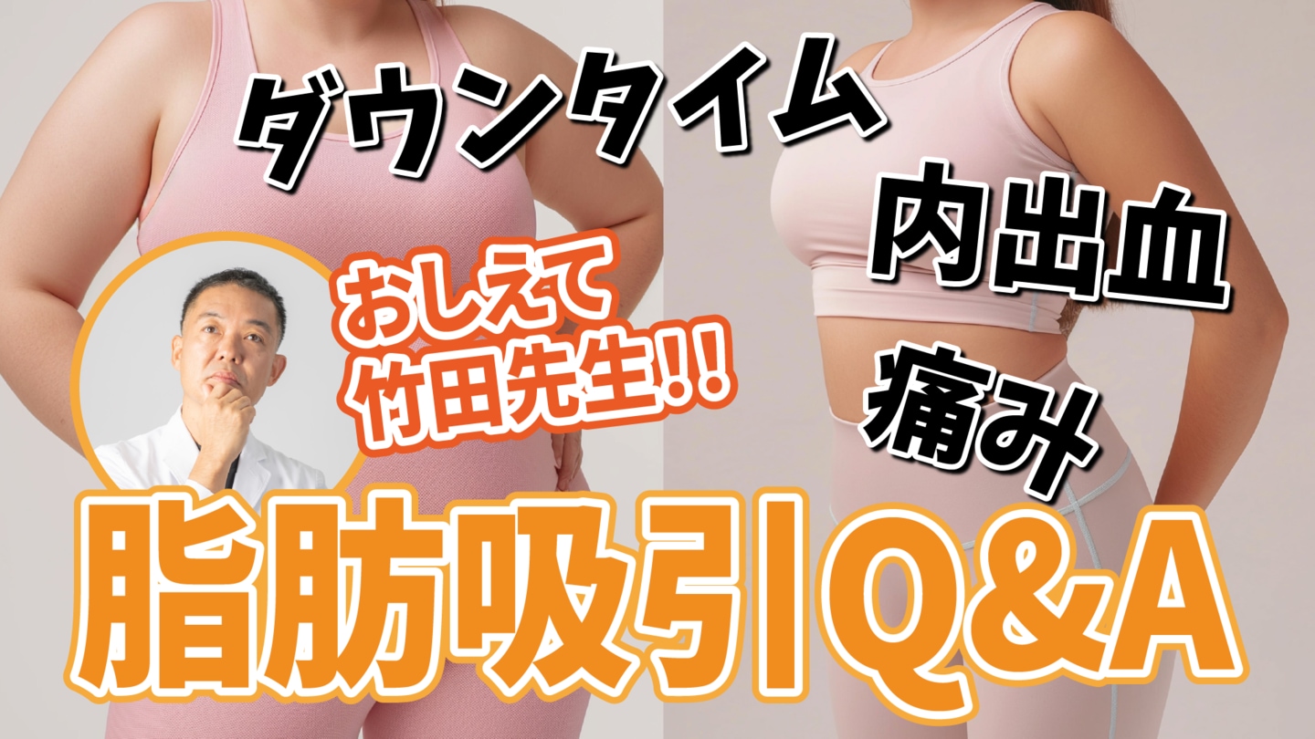 【脂肪吸引QA】施術時間/痛み/腫れ内出血/麻酔/ダウンタイム..気になる質問に脂肪吸引最高責任者がお答えします！【湘南美容クリニック・新橋銀座口院】