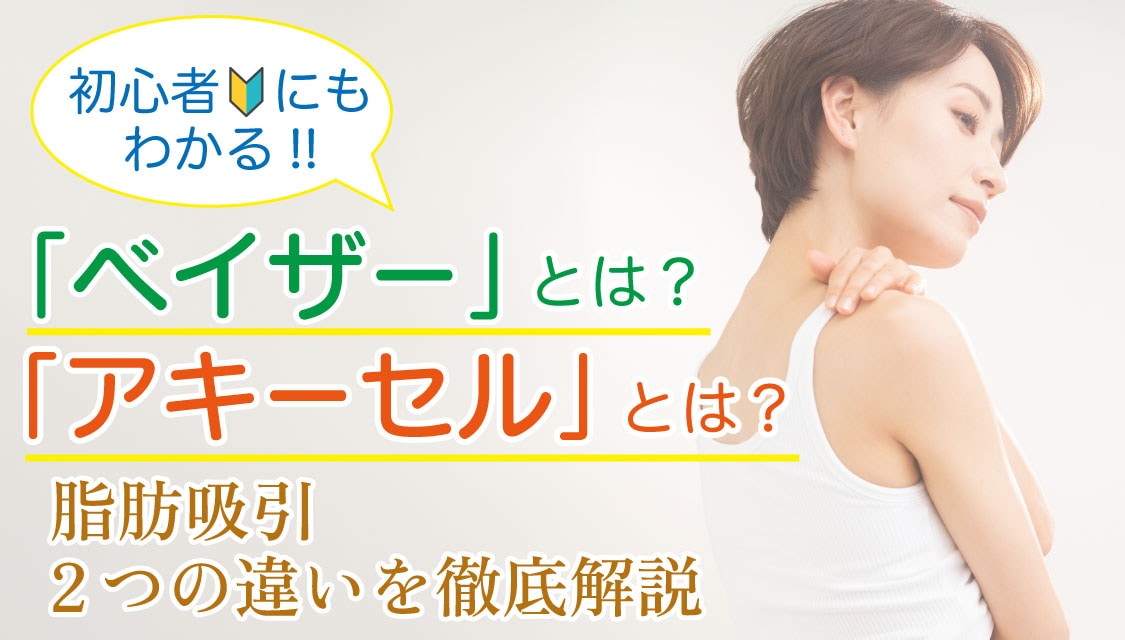 脂肪吸引　ベイザー　アキーセル　アキーセルとベイザーの違い　後悔　費用　効果　わかりやすい　違い　解説　ダウンタイム　新橋銀座口　ライポマティック　ベイザーアキーセル併用　どれがいい　メリット　デメリット　ダイエット　脂肪減少　痩身　痩身治療　医療美容　脂肪を減らす