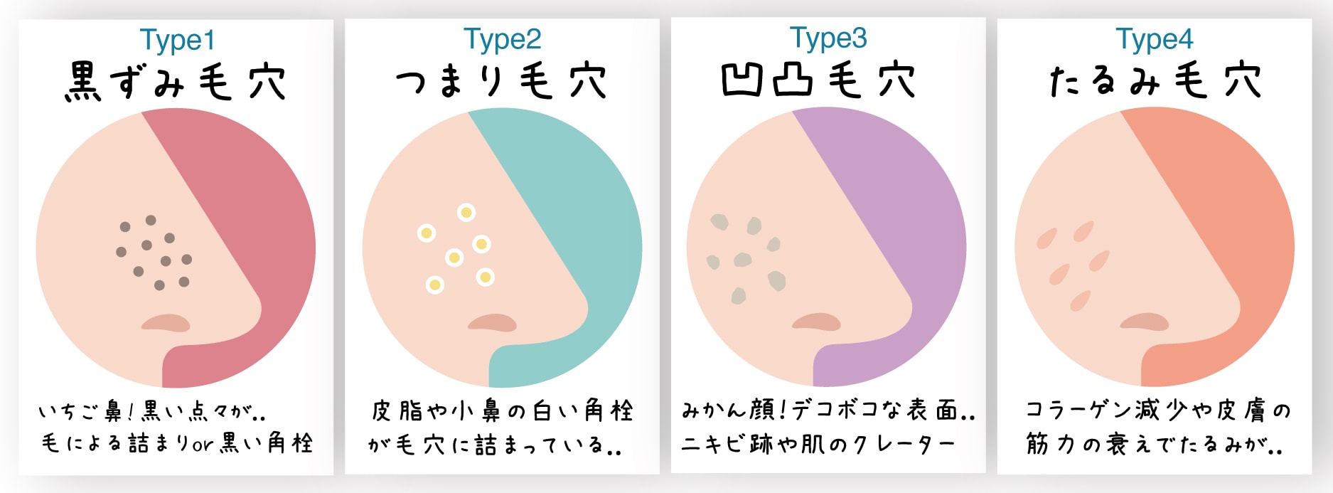 4つのタイプのうち、あなたはどのタイプの毛穴でお困りですか？