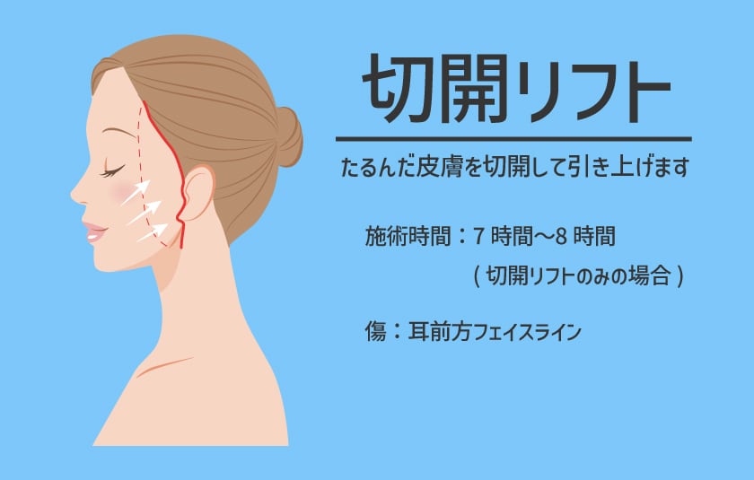 根本的な皮膚のたるみを改善！切開フェイスリフト