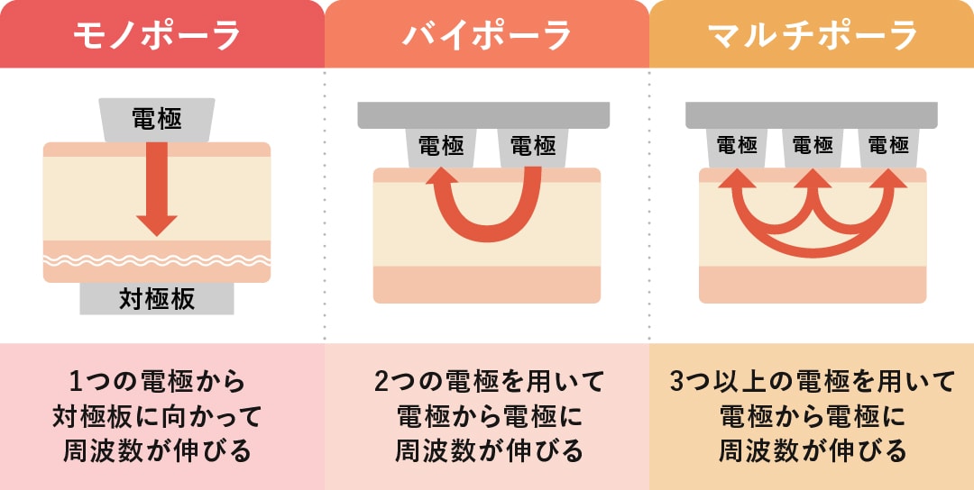 ラジオ波(RF)のアプローチ方法