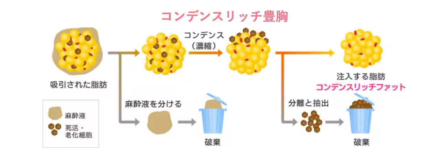 コンデンスって？