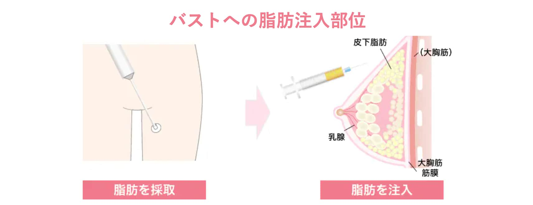 形・バストデザインへのこだわり