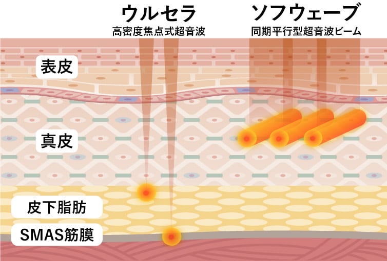 激痛セットはどんな人にオススメ？