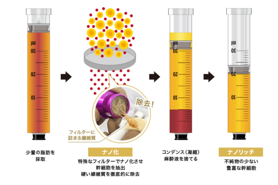 ナノリッチ