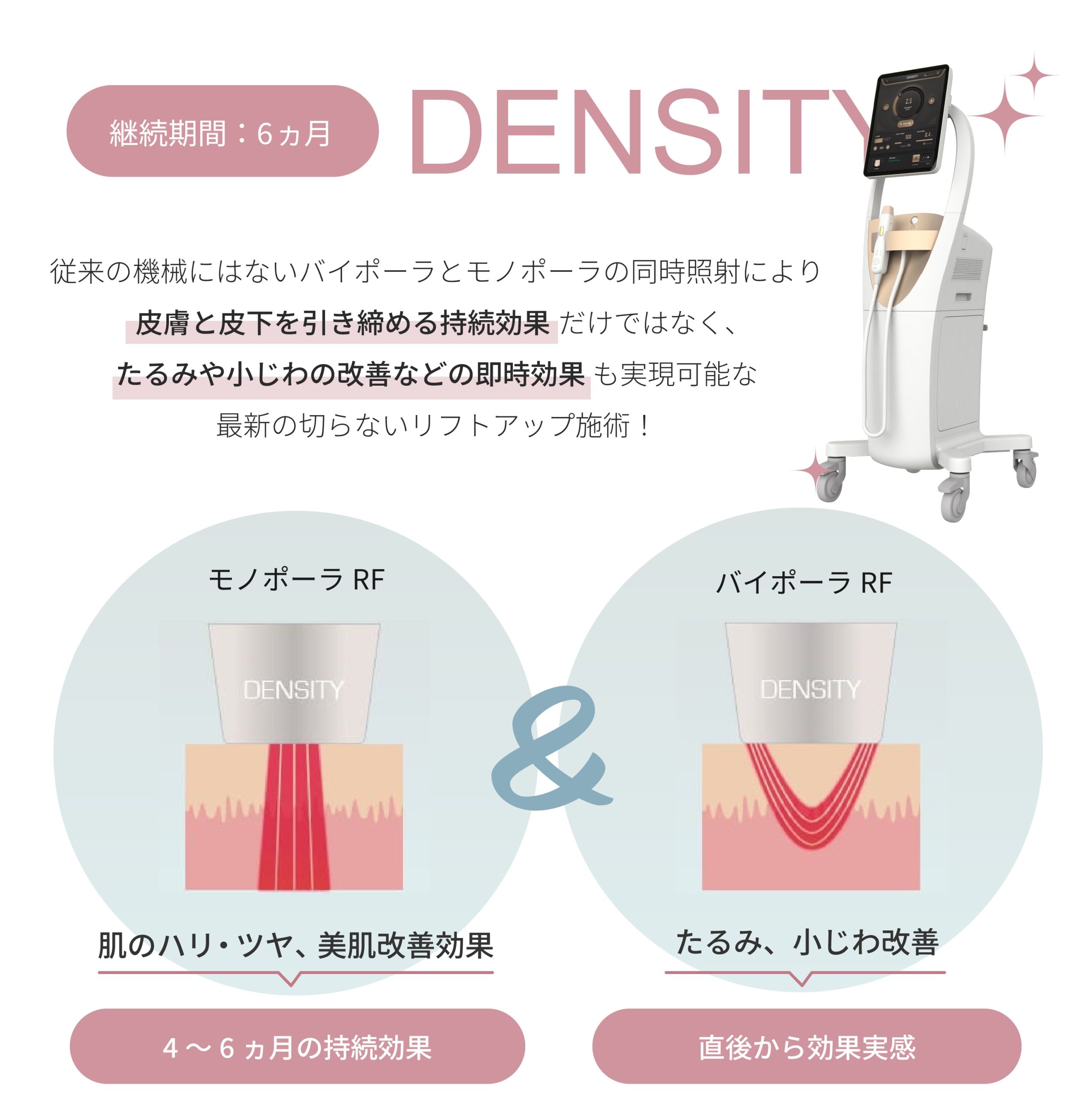 【 限定院のみ 】DENSITY（デンシティ）