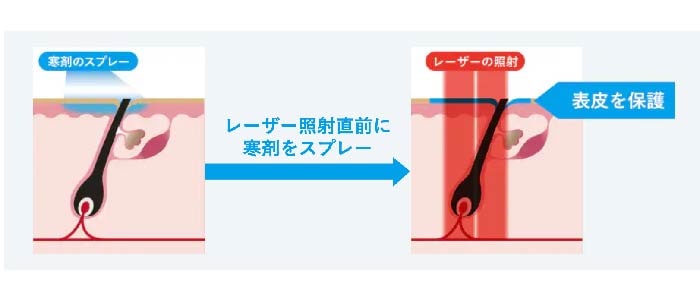 〈人気な理由③〉痛みを軽減させる冷却機能搭載