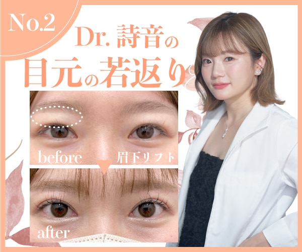 Dr.詩音の【目元の若返り】圧倒的に美しい仕上がりでスタッフ人気も絶大✨