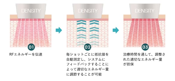 ポイント②　肌の状態を都度確認し、均一なエネルギーを照射