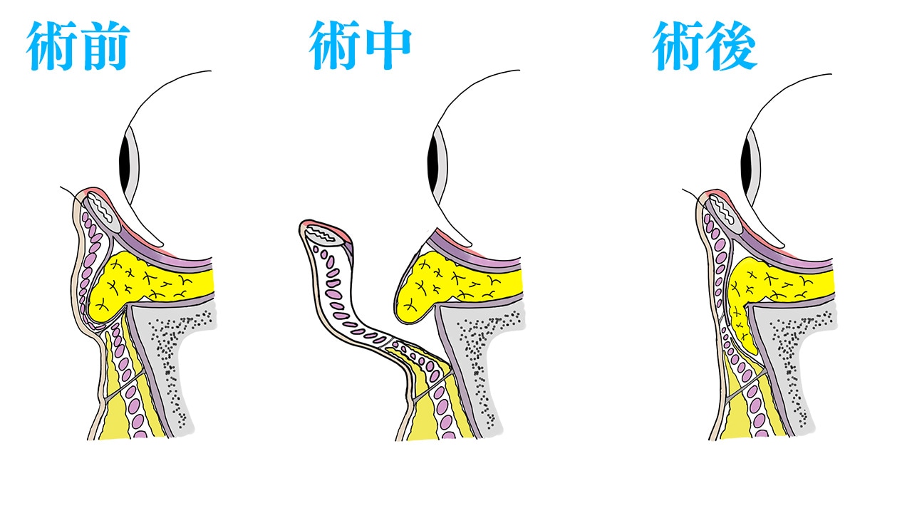 施術の流れ