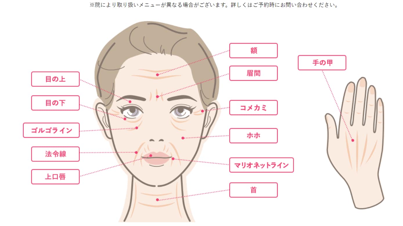 あらゆる箇所に注入が可能！