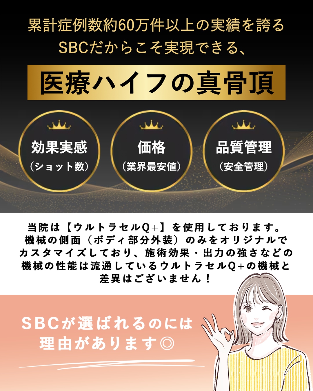 SBCが選ばれる理由とは