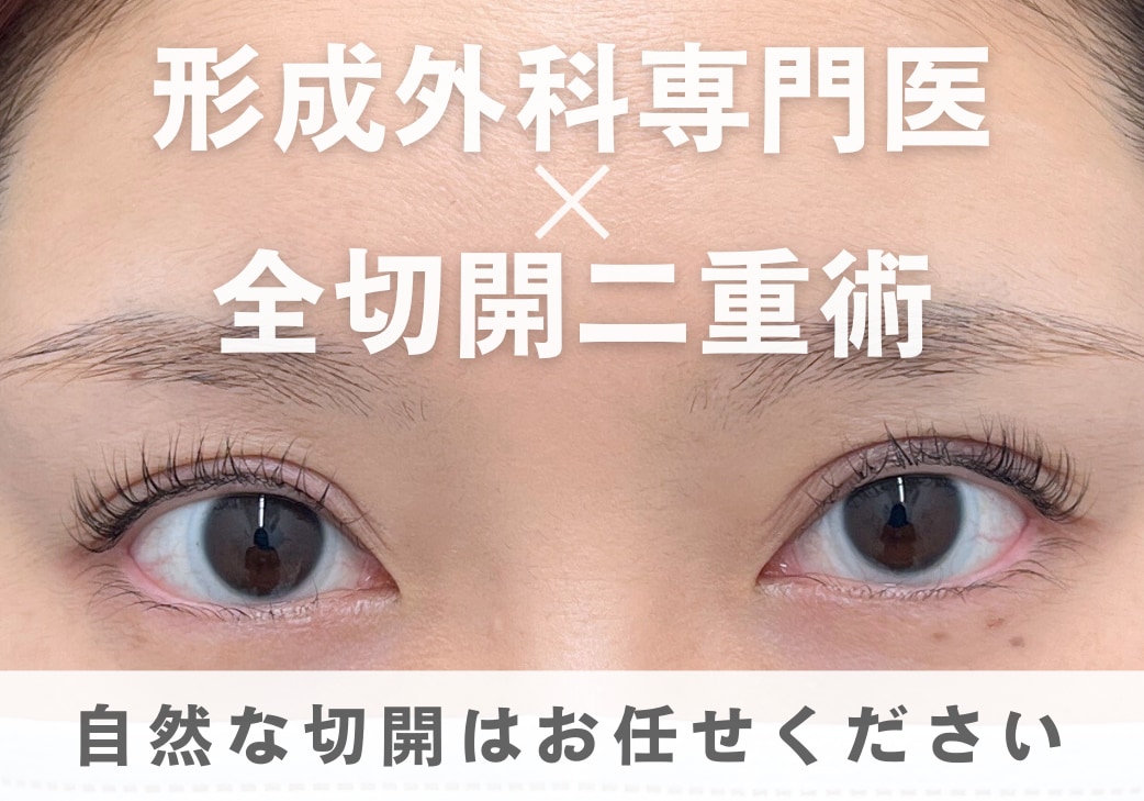 【全切開二重術】東海地方・愛知で自然な全切開をしたいなら形成外科専門医にお任せ！