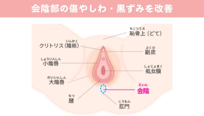 会陰部贅皮切除術