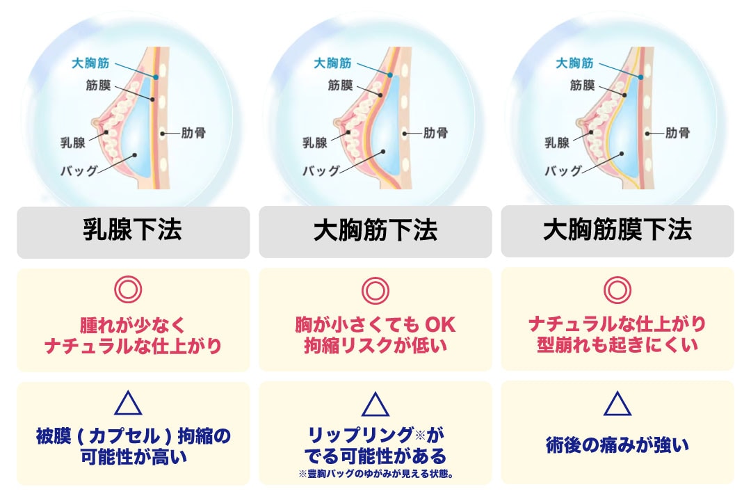 バッグの収納位置