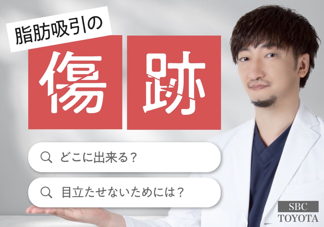 脂肪吸引の傷はどこにできる？実際の症例で見る傷跡とケア方法｜湘南美容クリニック豊田院