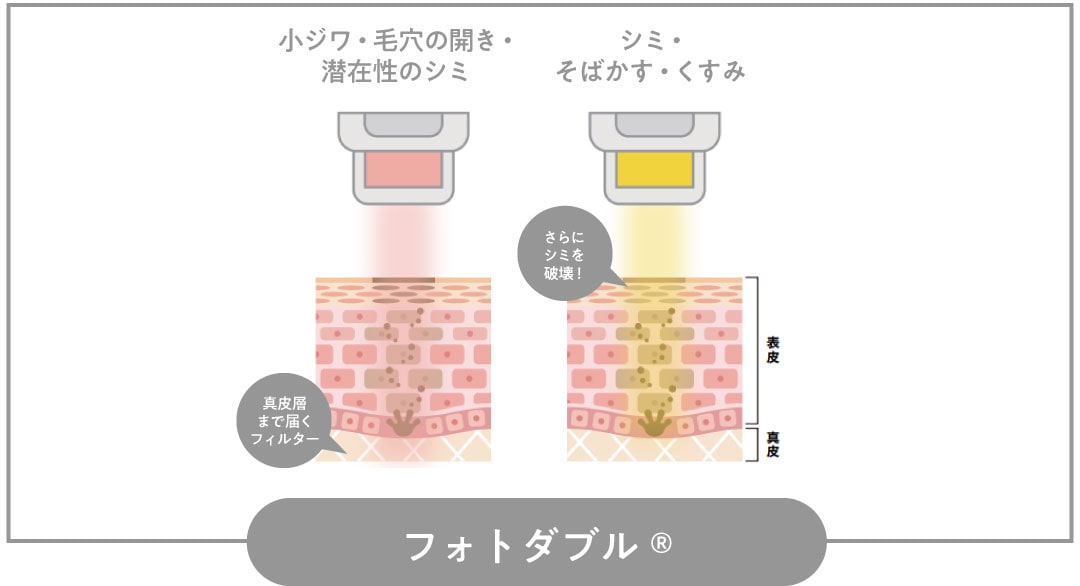 フォトダブル®︎とは？