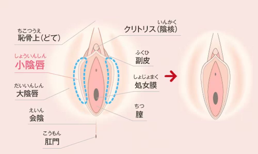 小陰唇（しょういんしん ）ってどこ？