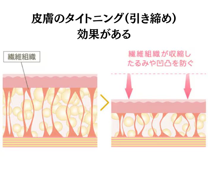 凹凸やたるみ防止！