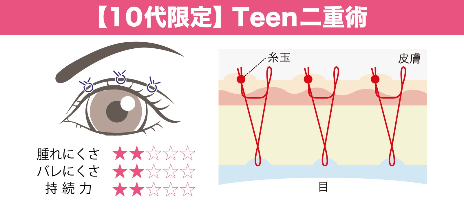 Teen二重術 (10代限定二重術)