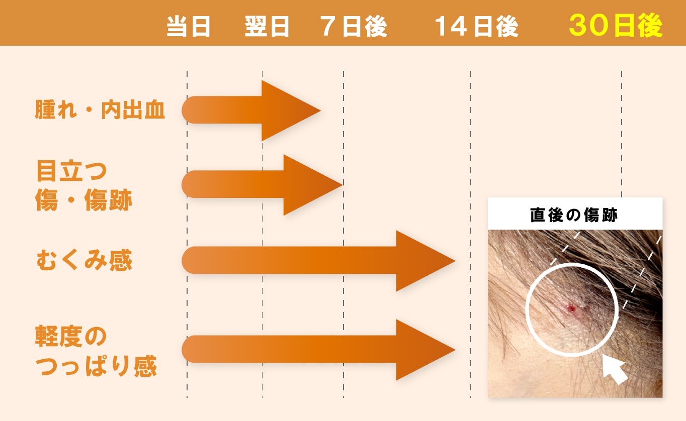 糸リフトの痛みやダウンタイムはどれくらいですか？