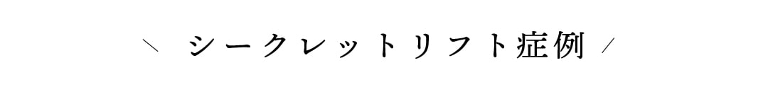 糸リフト神症例をチェック！糸リフトは金ドブなのか？