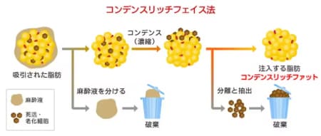 コンデンスリッチフェイス法とは？