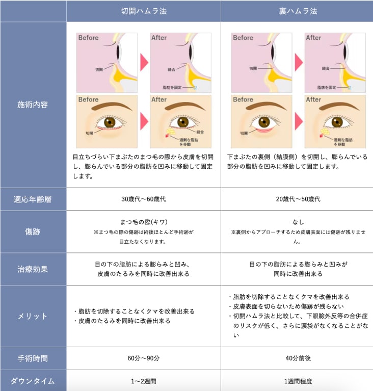 あなたはどっちを選ぶ？